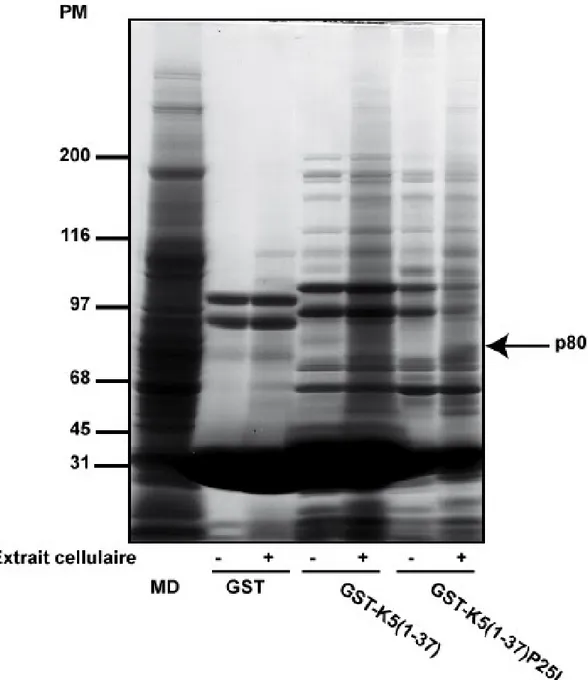 Figure 2. Identification d’une protéine p80 se liant à la kératine 5 sur une image numérisée d’un  gel SDS-PAGE, révélé avec le Bleu de Coomassie