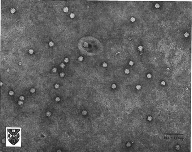 Figure 4 Photographie au microscope électronique du Virus de l’anémie aviaire (Stewart McNulty, Veterinary Sciences, The Queen’s University of Belfast).