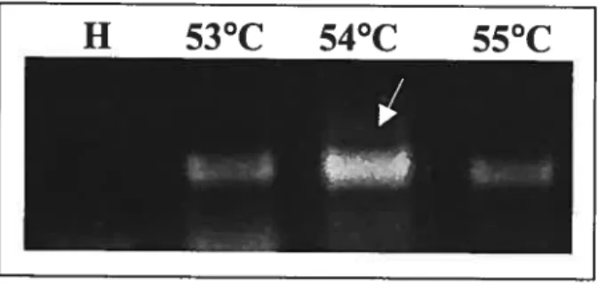 Figure 11: Influence de la température d’appariement dans la réaction de PCR.