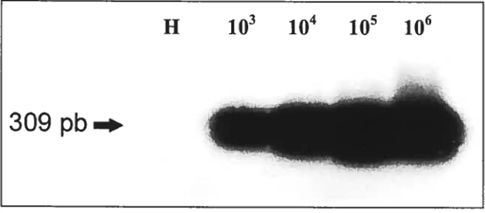Figure 13 : Évaluation de la technique de transfert de type Southem et de l’hybridation par la sonde biotinylée sur les produits de PCR