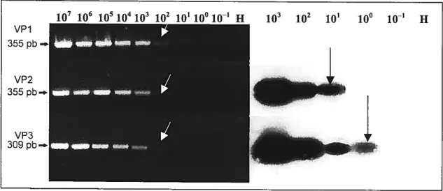 Figure 15 : Comparaison de la sensibilité de la réaction de PCR et du transfert de Southem à l’aide du plasmide pCux