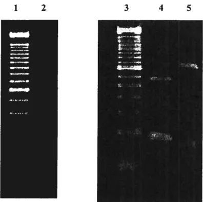 Figure 1. RFLP profiles of Cryptosporidium COWP gene after Rsa I digestion (left panel) and SSUrRNA gene after Ssp I ami Vsp I digestion (right panel)
