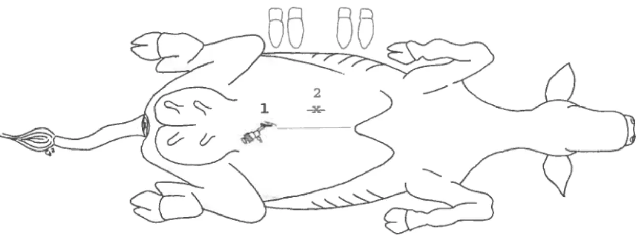 figure 6 : position du laparoscope (1), de la pince à préhension (x) et lieu de fixation de la caillette (ligne rouge en 2)