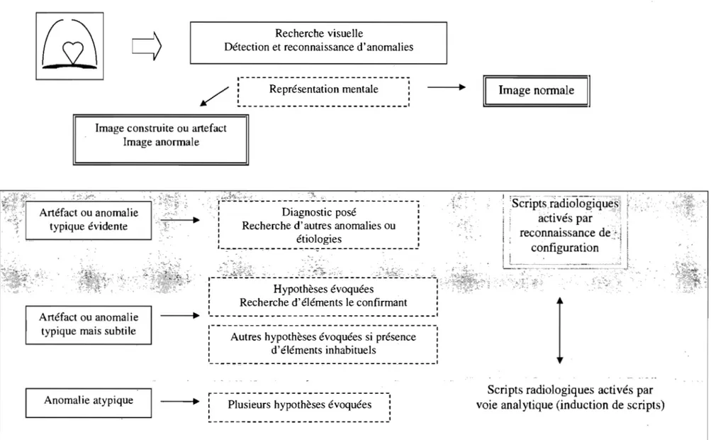 Figure 6.  Schéma du processus diagnostique d'une radiographie pulmonaire 