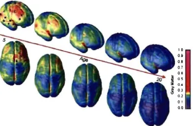 Figure 8 : Représentation corticale de  la maturation de  la matière grise (MG) chez l'enfant de 4  à  21  ans