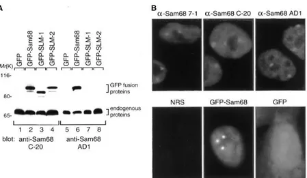 Figure  6 :  Localisation  de  SAM68  dans  les  SNBs  [147].  Après  avoir  généré  un  anticorps  anti- anti-SAM68  dit  « AD1 »,  Chen  et  al