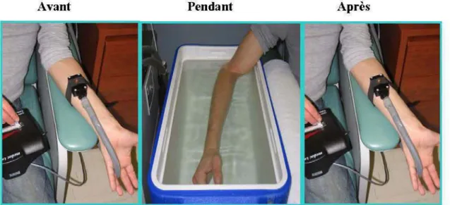 Figure 3. Test d'immersion dans le bain d'eau froide. 