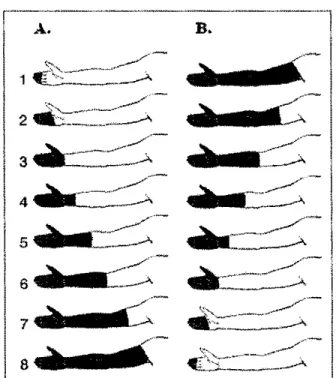 Figure  7.  Représentation schématique du  test  de sommation spatiale.  A. Au cours de la  séance ascendante, la surface stimulée  augmente; du bout des doigts  à  1' épaule