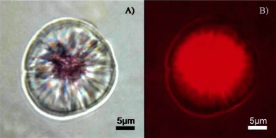 Figure 6. Photo du même otolithe marqué à l'alizarine rouge S observé (A) sous lumière blanche (on peut voir la marque colorée laissée sur le noyau de l'otolithe par l'alizarine) et (B) sous lumière UV ou l'on voie bien la fluorescence du noyau