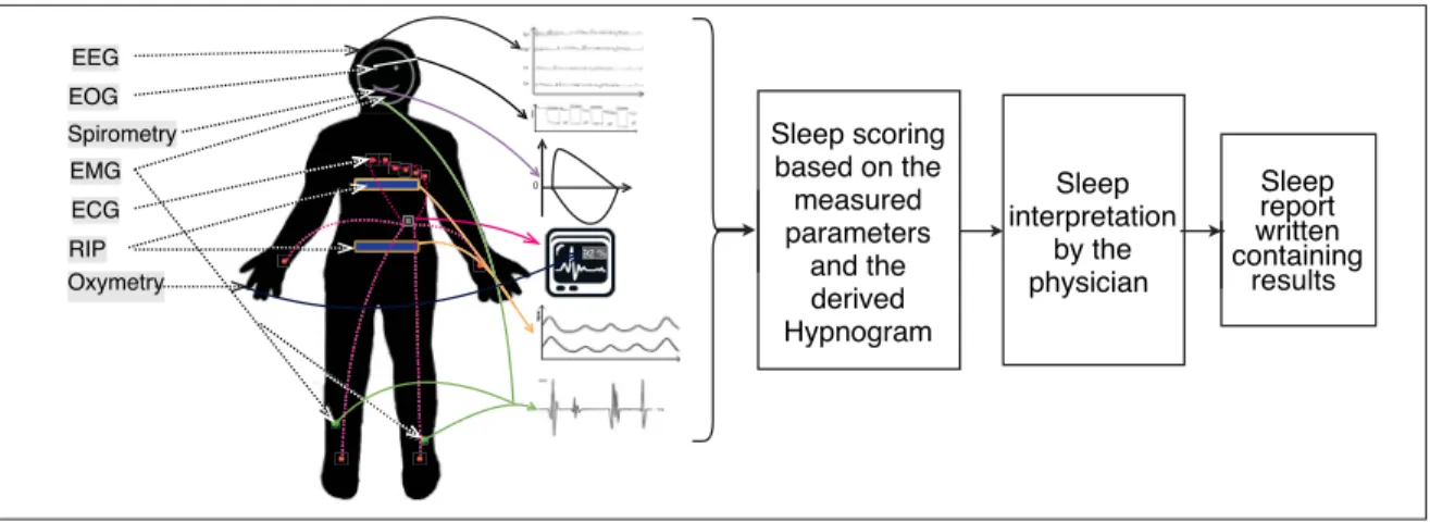 Figure 1.2 Typical acquisition protocol and general workﬂow in a PSG procedure. 22 sensors and wires, attached on the body