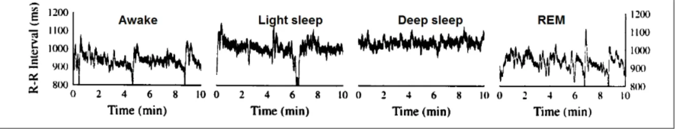 Figure 1.4 HRV changes with sleep stages. R-R intervals plotted over time during: Wake, Light (Including stages 2 or 3), deep (stages 3), and REM sleep Adapted from Togo &amp; Yamamoto (2001)