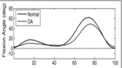 Figure 1.8 Comparaison de la flexion du genou entre sujets sains   (normal) et sujets arthrosiques (OA) dans le plan sagittal  