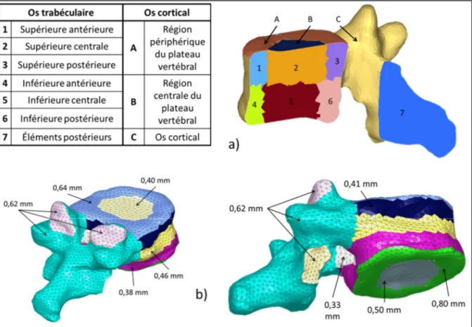 Figure 3.2 Présentation du modèle SM2S : a) différentes régions des vertèbres,   b) hétérogénéité de l'épaisseur de l'os cortical 