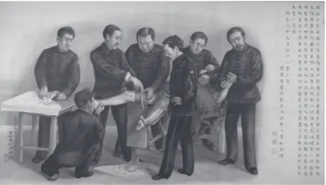 Figure 1 : Amputation effectuée à l’Hôpital temporaire de l’Armée   de terre à Osaka lors de la guerre civile du sud-ouest