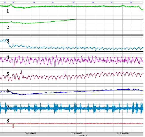 Figure 8.7 Module Universel Biopac.  