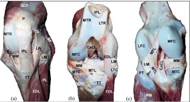 Figure 1.2 Dissection grossière d'un grasset bovin gauche; (a) vue crâniale péri- péri-articulaire où la capsule péri-articulaire et la graisse ont été retirées; (b) vue crâniale  intra-articulaire où la patella (P), ligaments patellaires (MPL, IPL, LPL) e