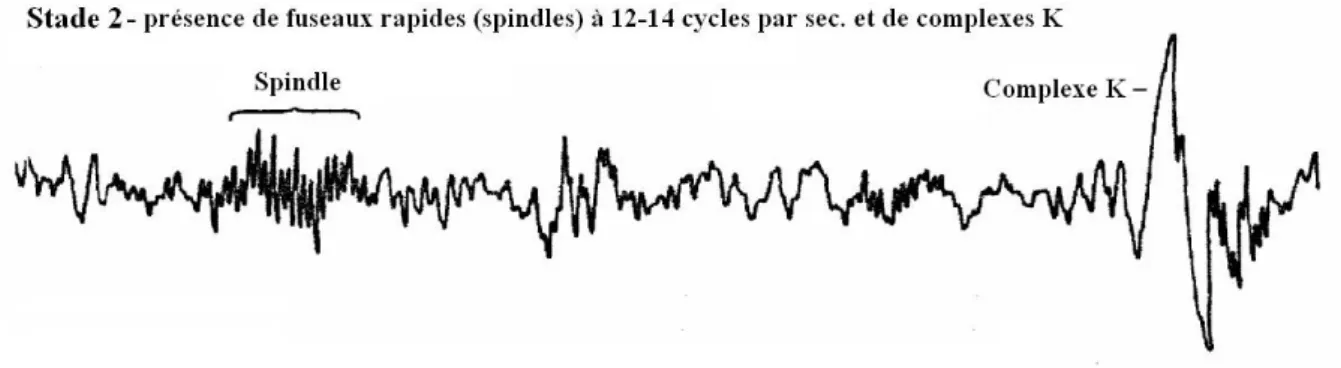 Figure 18 : Exemple de tracé électroencéphalographique pendant le stade 2 du sommeil lent [p