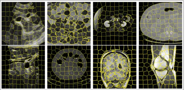 Figure 1.11 Example of super-pixel clustering using the SLIC algorithm