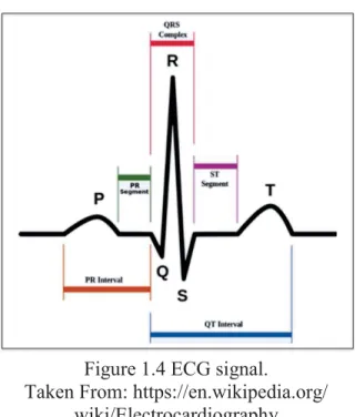 Figure 1.4 ECG signal. 