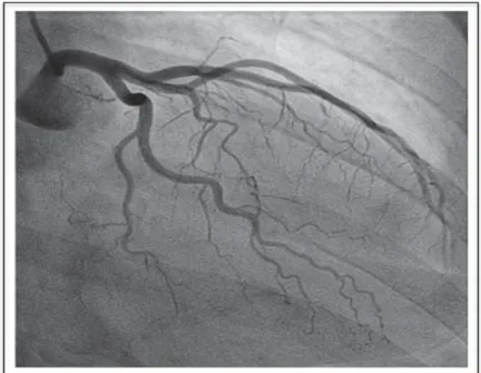 Figure 1.5 A sample of coronary angiogram frame. 