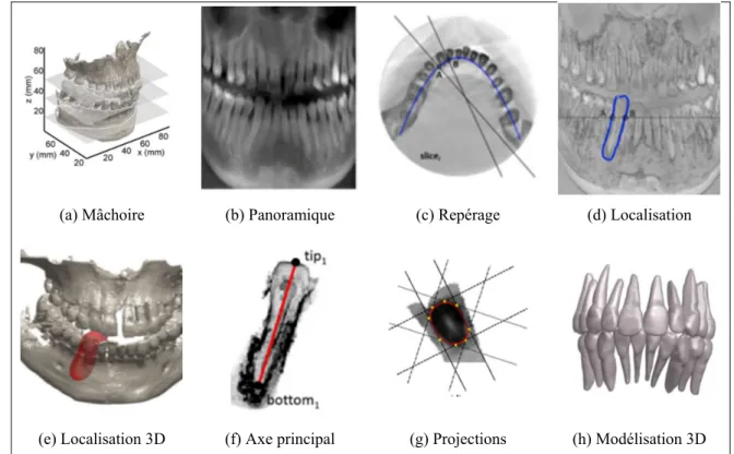 Figure 1.22 Segmentation anatomiquement contrainte  Adaptée de Barone (2015) 
