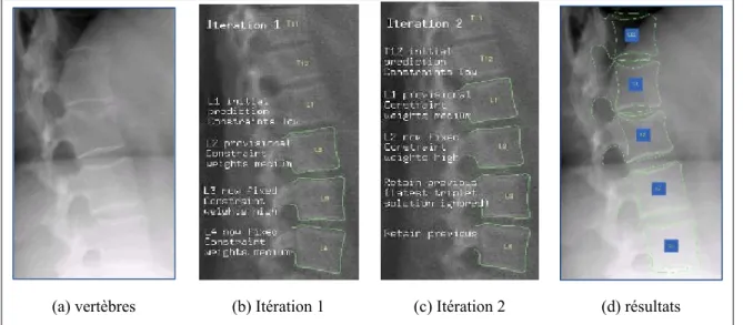 Figure 1.26 Illustration de la méthode de Roberts  Tirée de Roberts (2008) 