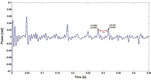 Figure 3.8 – La phase instantanée estimée par Hilbert du signal d’accélération du modèle d’engrenages avec une ﬁssure de 0.6 mm.