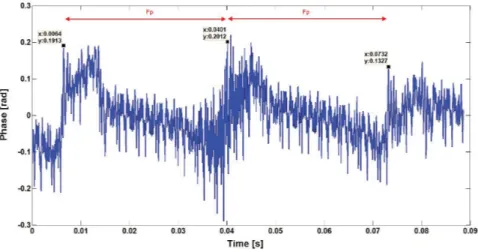 Figure 3.17 – La phase instantanée estimée par ESPRIT du signal d’accélération du modèle d’engrenages avec une ﬁssure de 0.6 mm