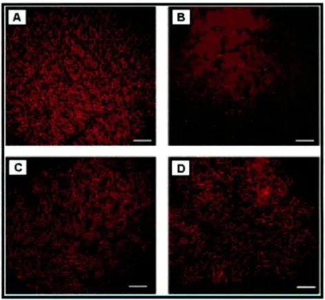 Figure 1 : Quatre coupes transversales du muscle tibial antérieur de souris MDX. La fluorescence (technique d'immunofluorescence) accentue les différences entre (A) une souris saine, (B) atteinte de dystrophie musculaire de Duchenne, (C) traitée par greffe