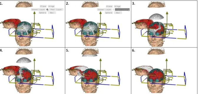 Figure 1.8 Démarrage d'une animation de façon discrète dans un prototype de visualisation  de données volumiques 