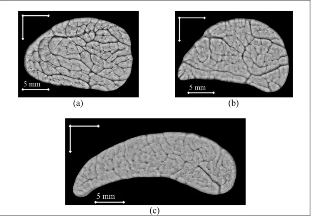 Figure 5.2 Typical macro-photograph images of a SDFT. The dark lines are  the interfascicular spaces, and the structures enclosed by the endotendon are  fiber fascicle bundles : (a) proximal CSA ; (b) middle CSA ; and (c) distal CSA