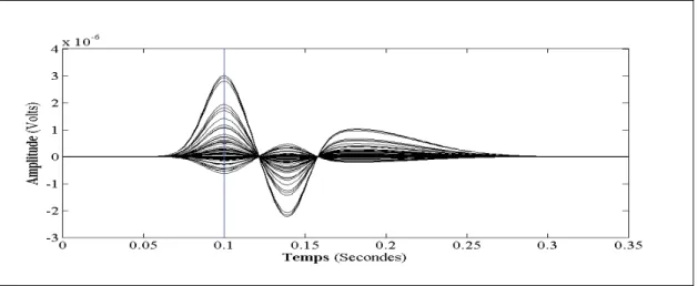 Figure 3.4 Signal de la simulation EEG sans bruit physiologique. 