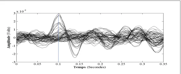 Figure 3.8 Signal de la simulation EEG avec bruit physiologique. 