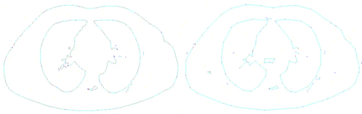 Fig. 4.5 – Résultats de segmentation obtenus avec différents seuils de précision