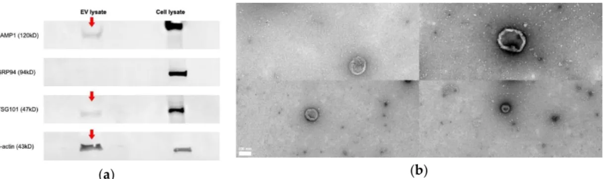 Figure 1. Purification and characterization of extracellular vehicles (EVs) released from tracheal organ  culture (TOC)