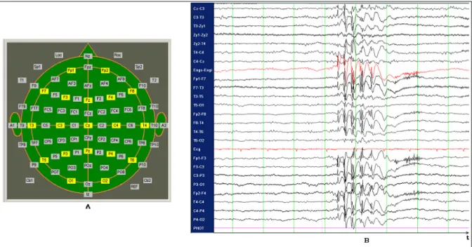 Figure 1.2  A) La disposition topographique des électrodes en vue de dessus; 