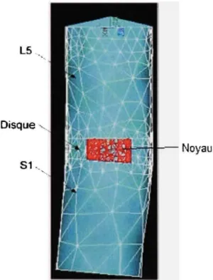 Figure 4.8 Modèle par éléments finis des vertèbres L 5  - S I 