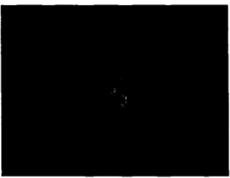 Figure 2 Exemple de photo d'immunofluorescence 