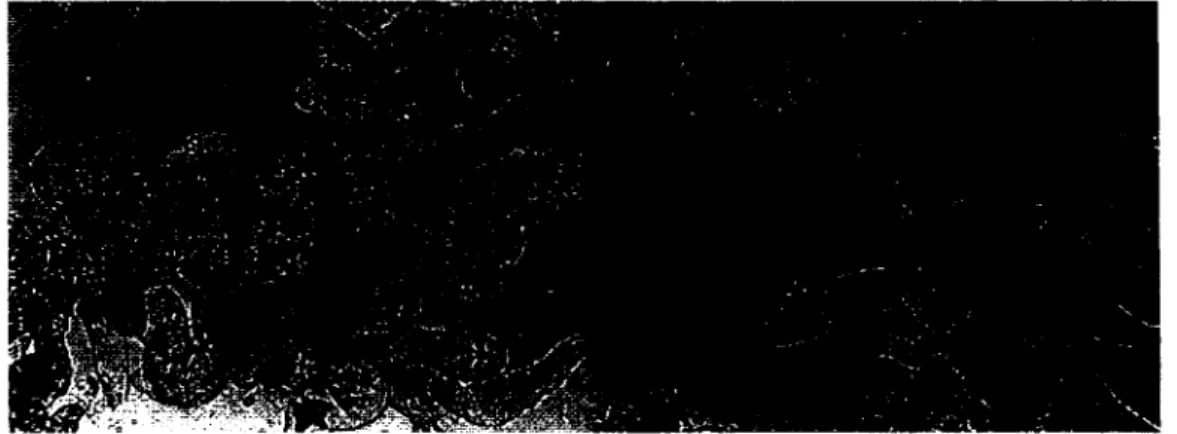 Figure 9 Exemples de cellules mal préparées 