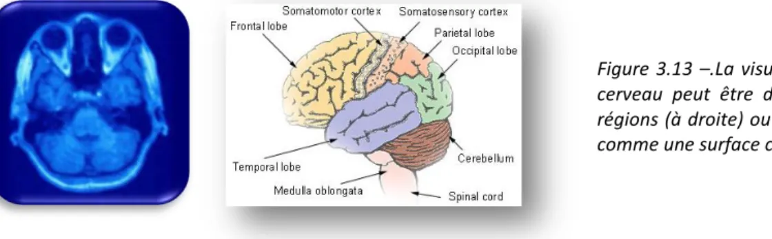 Figure  3.13  –.La visualisation du  cerveau  peut  être  découpée  en  régions (à droite) ou être perçue  comme une surface continue