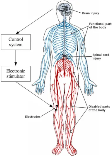 Figure 2.9: Principle of operation of neuroprostheses. Components of the system are the control system, stimulator, sensory feedback (not shown) and electrodes.