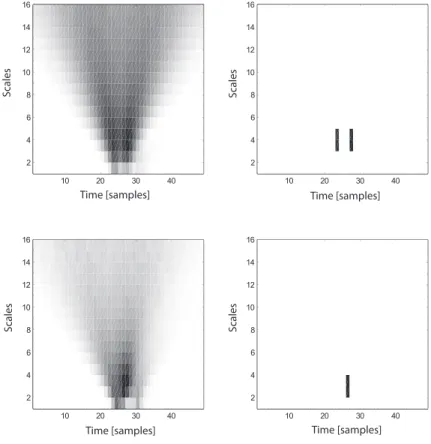 Figure 4.2: Top left: time-scale representation of one action potential waveform. Top right:
