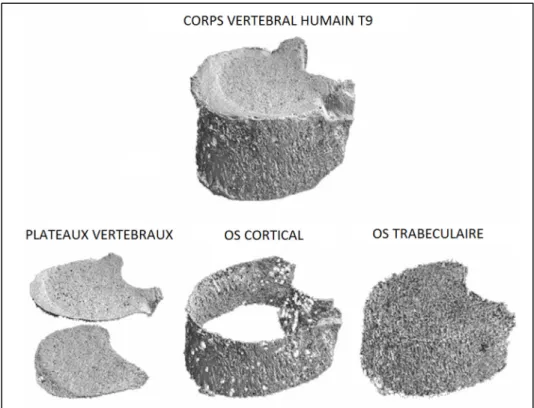 Figure 1.3 Identification de la macrostructure du corps vertébral   Adaptée de (Fields, Lee et Keaveny, 2010)  