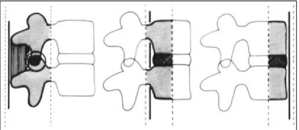 Figure 1.9 Illustration du concept des trois colonnes  Adapté de Denis (1983) 