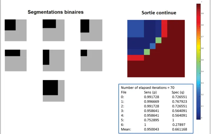 Figure 1.9 Sept segmentations binaires sont présentées (gauche).