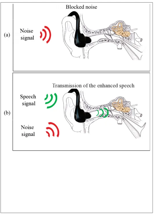 Figure 0.2 The operating principle of the smart hearing protection device: (a) block noise, (b) let enhanced speech and