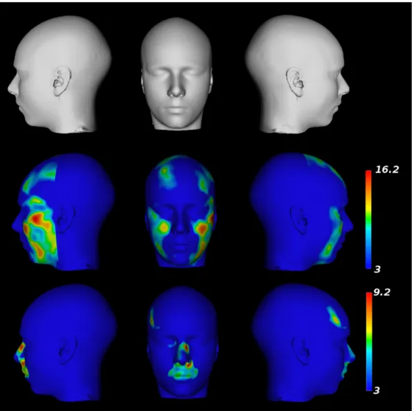 Figure 3. Results from the voxel-by-voxel analysis of deformation fields. Top Row: A surface rendered version of the population-based atlas