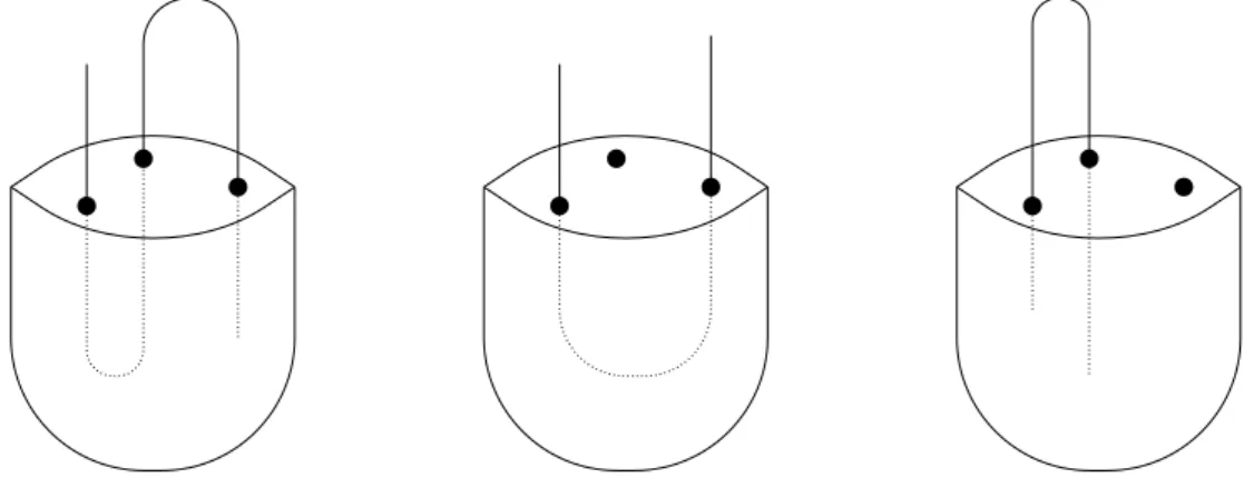 Figure 3: Trois possibilités qu’un plus long chemin croise un sac de la décomposition arborescente