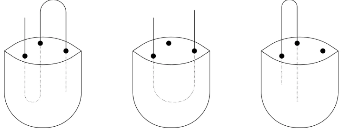 Figure 1.3: Three different ways a longest path can cross a bag of a tree-decomposition.