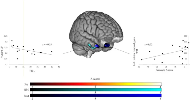 Figure 5 Links between specific brain alterations and cognition in SD patients. Spearman correlations between  voxel-based morphometry clusters and cognition/behavior with FA values of the right uncinate fasciculus and  negative FBI, WM atrophy in the left